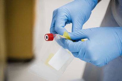 THL: Pohjois-Pohjanmaalla 97 uutta koronavirustartuntaa, joista yksi Taivalkoskella – tehohoidossa olevien potilaiden määrä noussut OYSissa