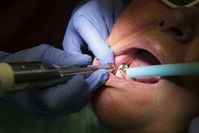 Yksityisiä hammaslääkäreitä vaivaa asiakaspula, vaikka suunterveyden hoitovelka jatkaa paisumistaan – Hammaslääkäriliitto pitää tilannetta kestämättömänä