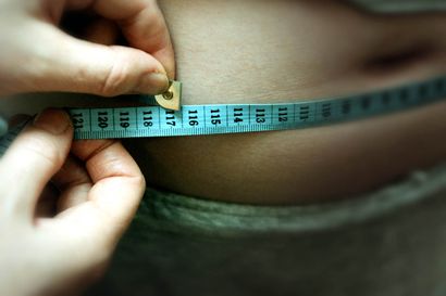 Iho ei palaudu rajusta painonpudotuksesta – Ennen ja jälkeen -kuvista näkyy, miten vatsanpeitteiden korjausleikkaus kiristää elämää nähnyttä nahkaa
