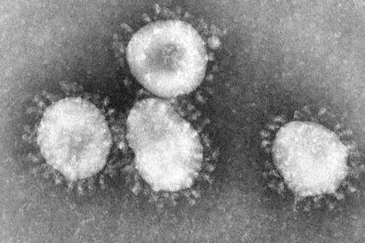 Suomessa kehitetty nenäsumute suojaa myös koronaviruksen muunnoksia vastaan