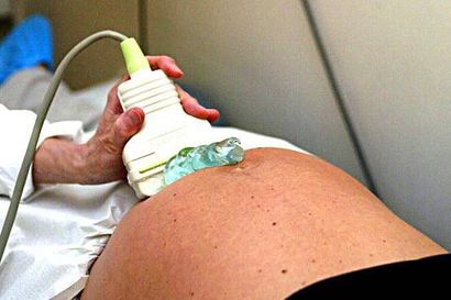 Rovaniemi kerää tarinoita raskausajasta ja synnytyksestä – Keräys on osa potilas- ja asiakasturvallisuuspäivää