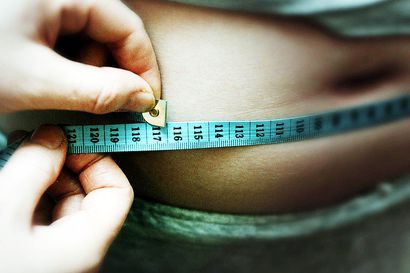Lihavuuden hoito tarvitsisi tiukat ohjeistukset – erikoissairaanhoitoon tulevien keskipaino noussut kymmeniä kiloja