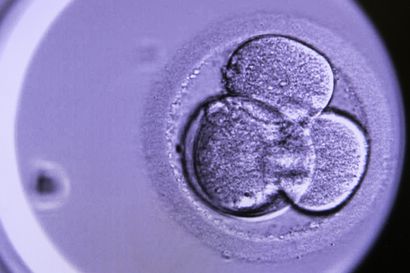 Suomi on alkiotutkimuksissa Pohjoismaiden sallivimpia, Islannissa laki sallii myös sukupuolen valinnan – "Käytössä on menetelmiä, joilla voi nähdä kaikki kromosomimuutokset"